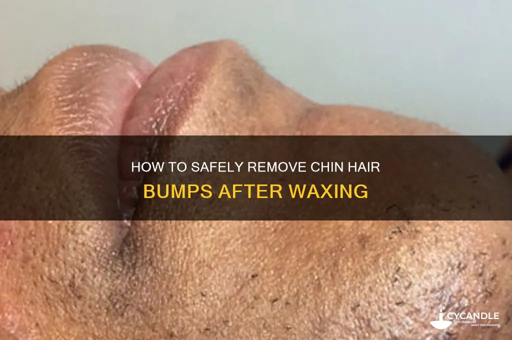 can i wax off chin hair bumps