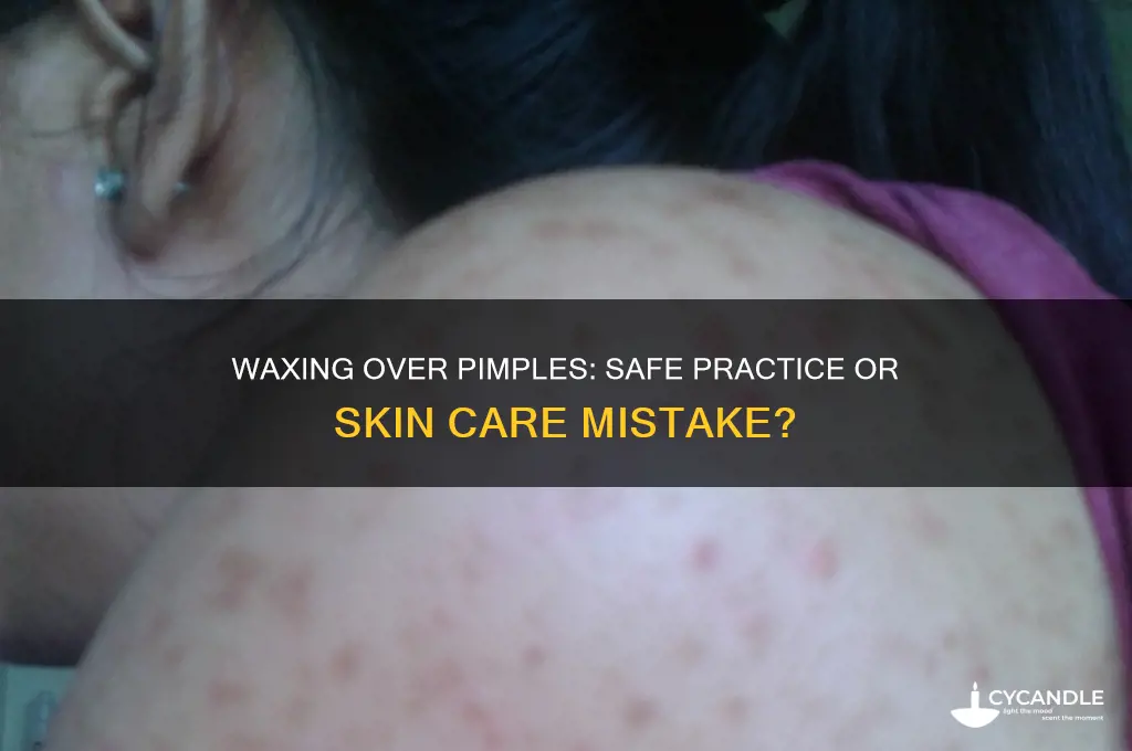 can i wax over a pimple