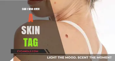 Waxing Over Skin Tags: Safe Practice or Potential Risk?