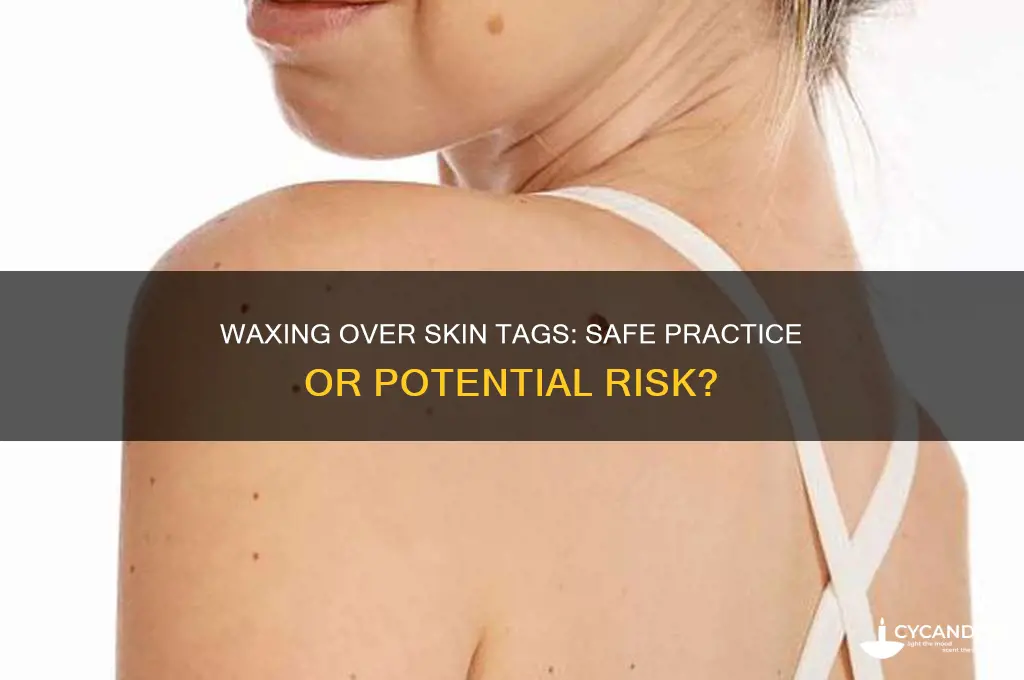 can i wax over a skin tag