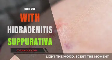 Waxing with Hidradenitis Suppurativa: Safe or Risky Choice?