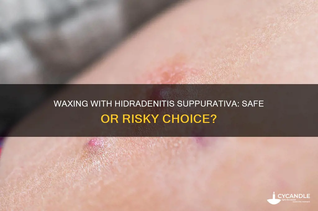 can i wax with hidradenitis suppurativa