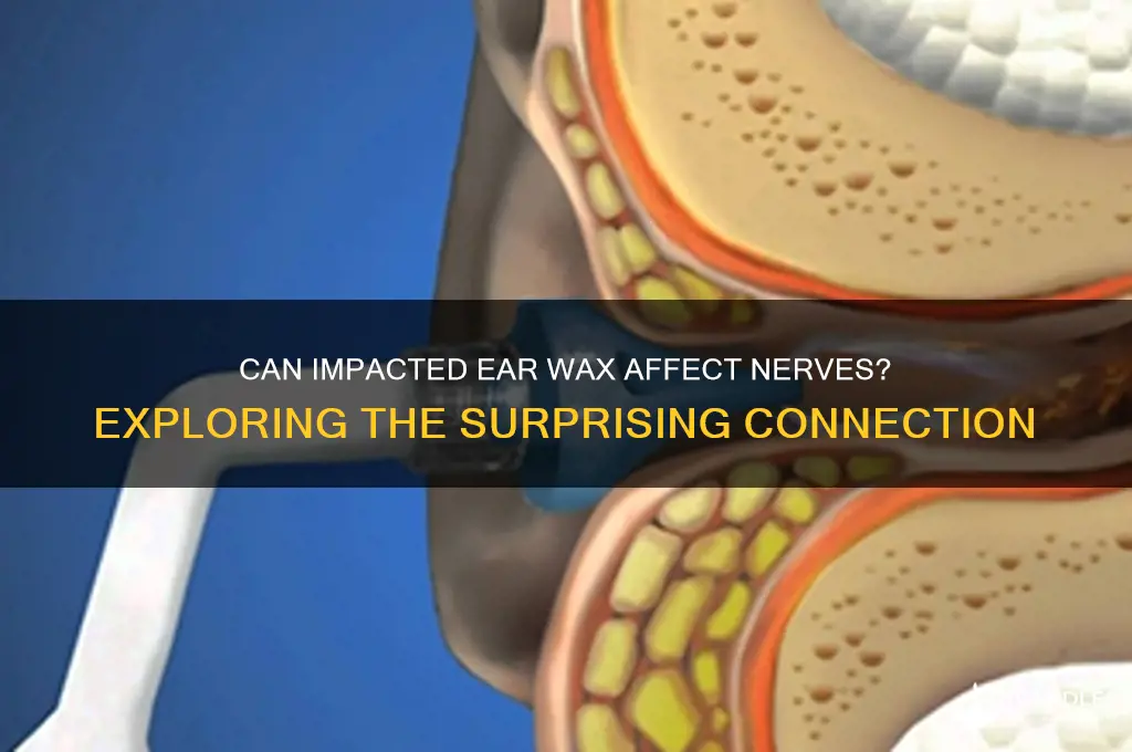 can impacted ear wax affect nerves