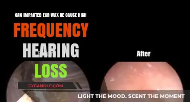 Impacted Ear Wax: A Hidden Culprit Behind High-Frequency Hearing Loss?