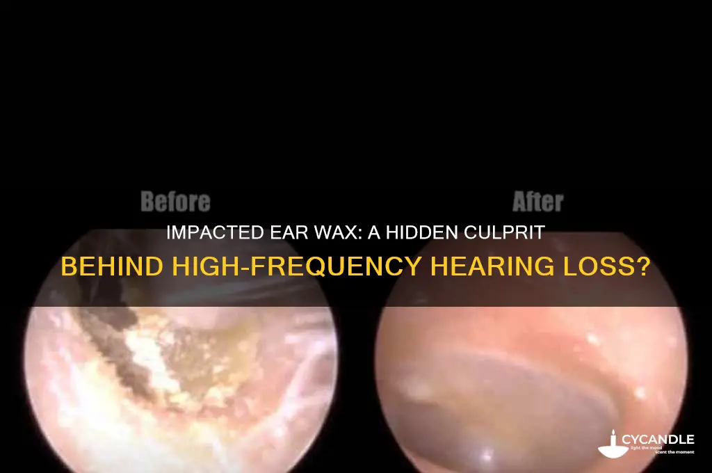 can impacted ear wax be cause high frequency hearing loss