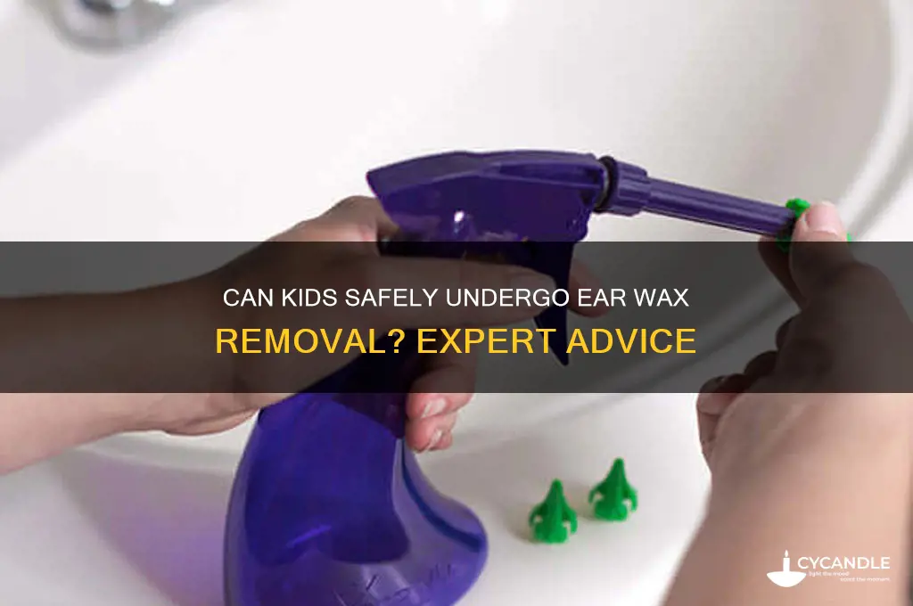 can kids get ear wax removal