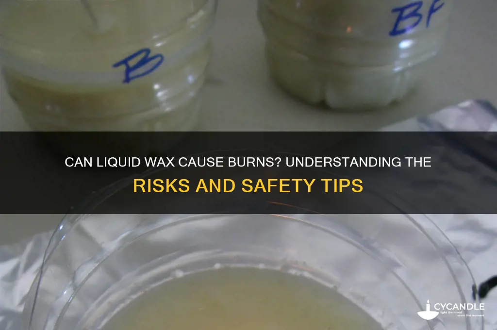 can liquid wax burn you