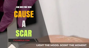 Can Melting Wax Cause Scars? Understanding Burns and Healing