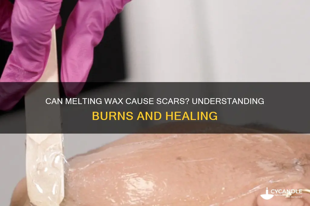 can melting wax cause a scar
