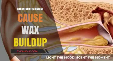 Meniere's Disease and Ear Wax Buildup: Unraveling the Connection