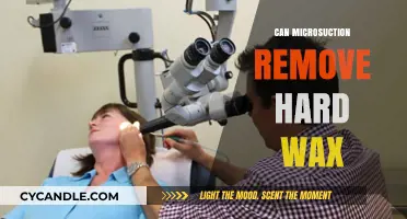 Can Microsuction Effectively Remove Hard Ear Wax? A Comprehensive Guide