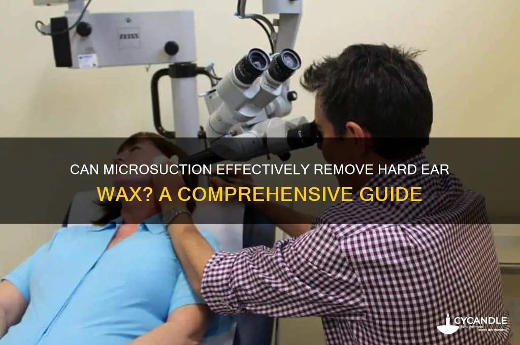 can microsuction remove hard wax