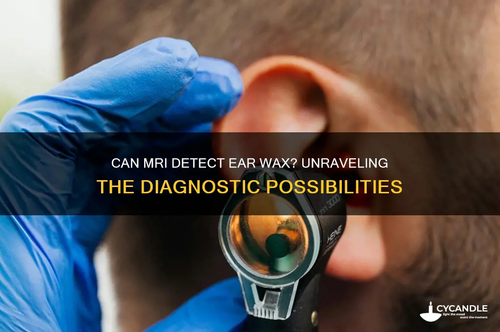can mri detect ear wax
