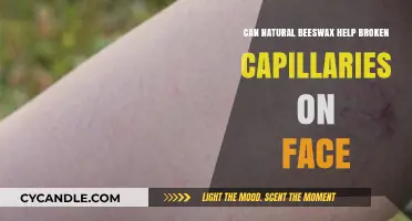 Natural Beeswax: A Gentle Remedy for Facial Broken Capillaries?