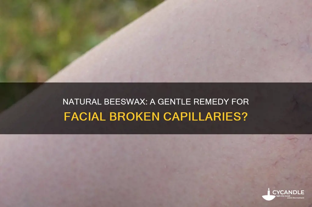 can natural beeswax help broken capillaries on face