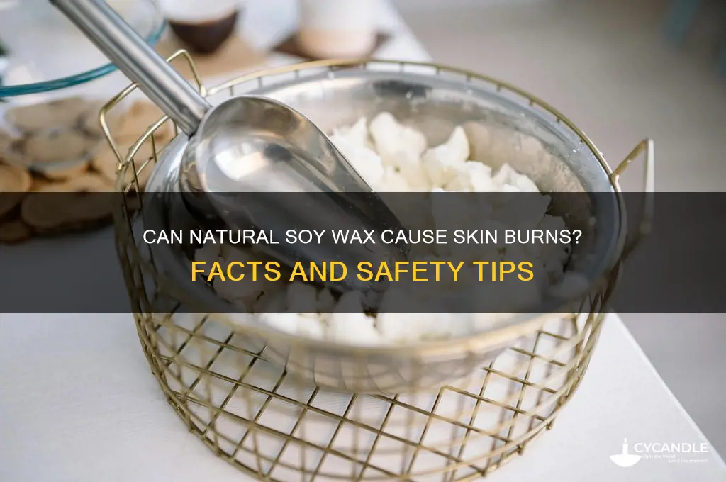 can natural soy wax burn your skin