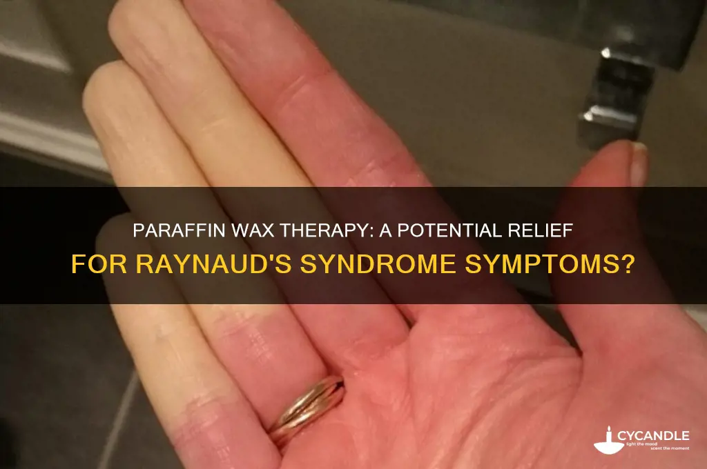 can paraffin wax be used for raynaud