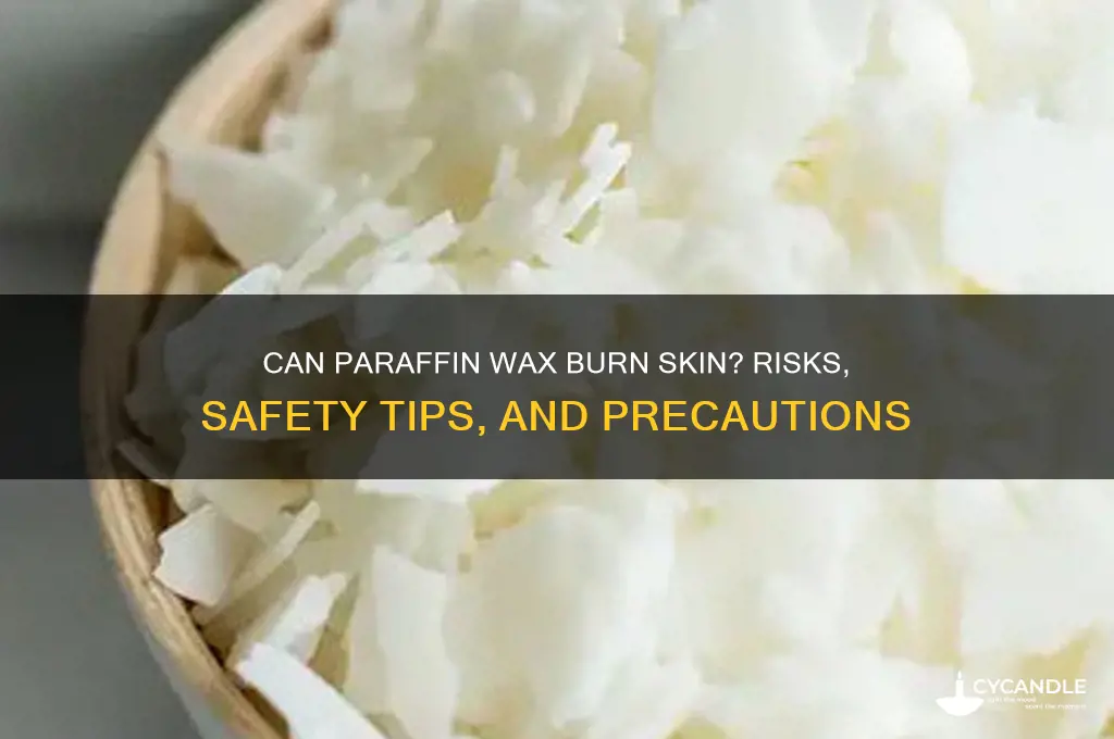 can paraffin wax burn skin