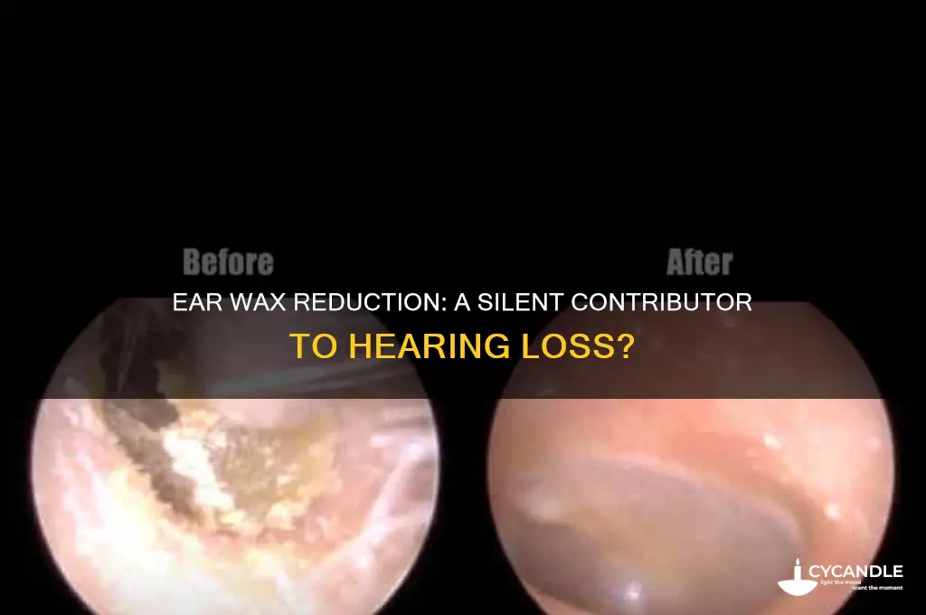 can producing less ear wax lead to hearing loss