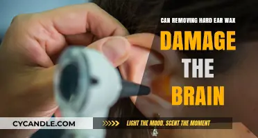 Ear Wax Removal Risks: Can It Harm Your Brain?
