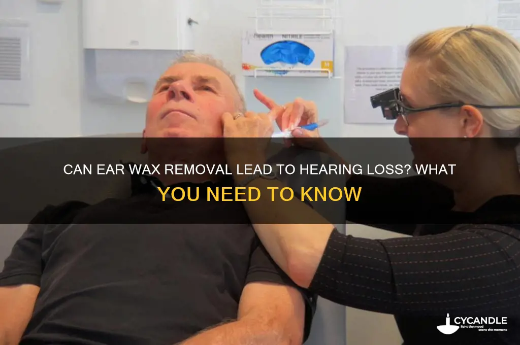 can removing wax cause hearing loss