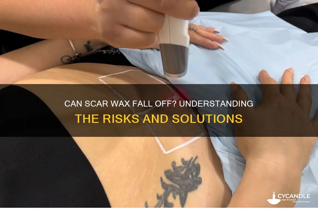 can scar wax fall off