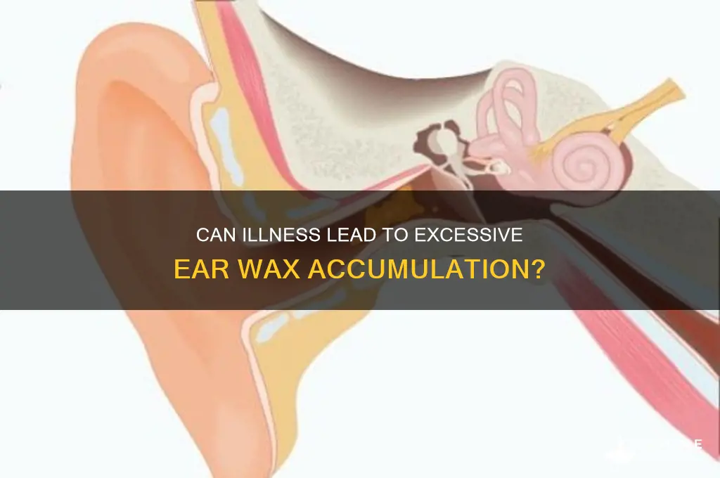 can sickness cause ear wax build up