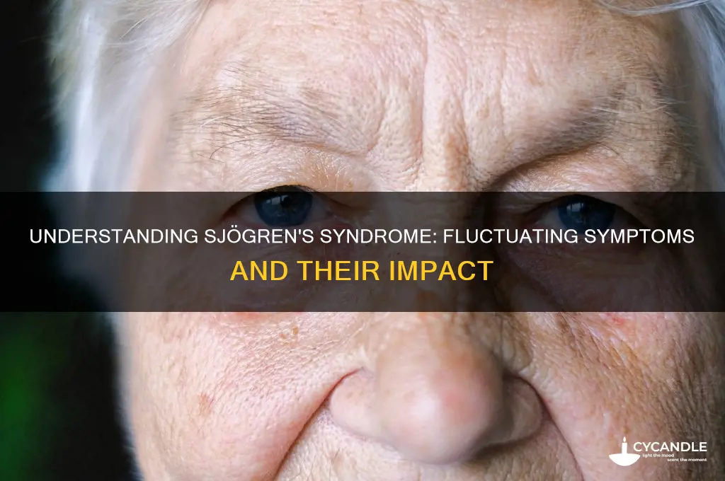 can sjogren