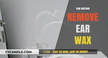 Can Suction Safely Remove Ear Wax? Expert Insights and Tips