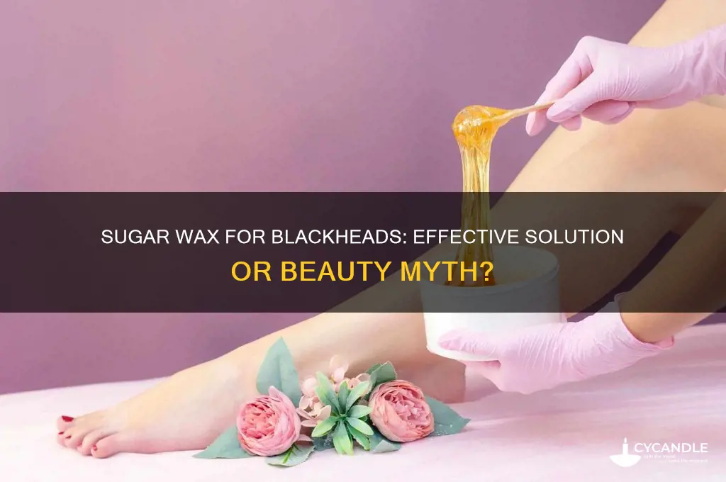 can sugar wax remove blackheads