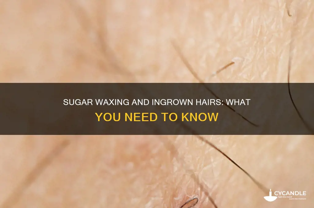 can sugar waxing cause ingrown hairs