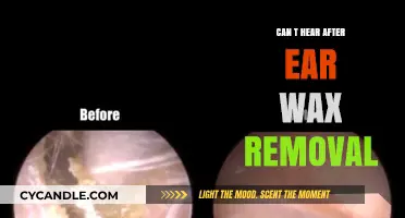 Post-Ear Wax Removal Hearing Loss: Causes, Risks, and Recovery Tips