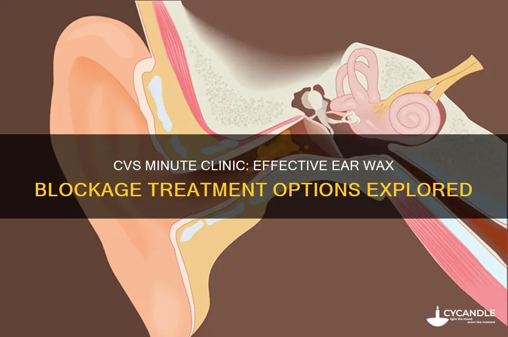 can the cvs minute clinic deal with ear wax blockage