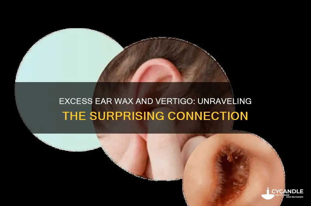 can too much ear wax cause vetigo