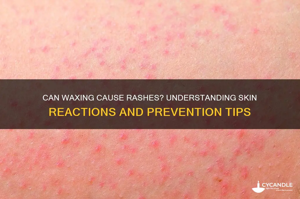 can u get a rash from waxing