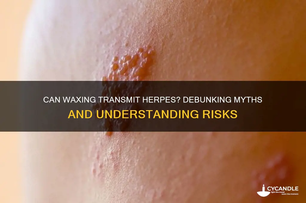 can u get herpes from waxing