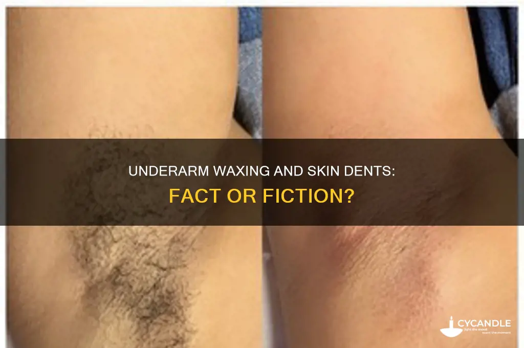 can underarm waxing cause a dent