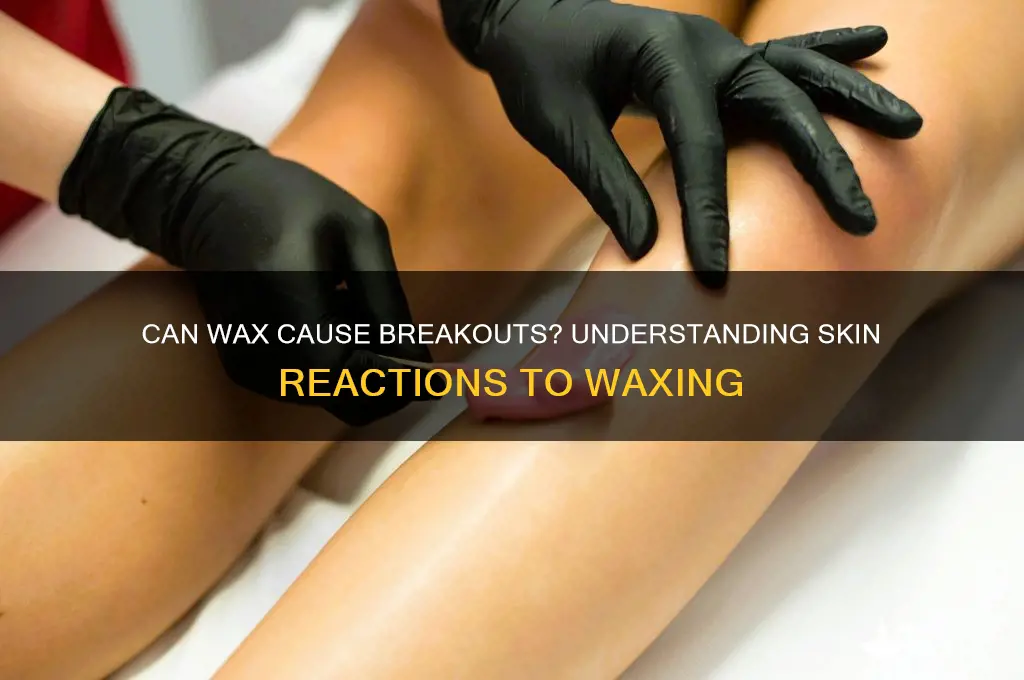 can wax break you out