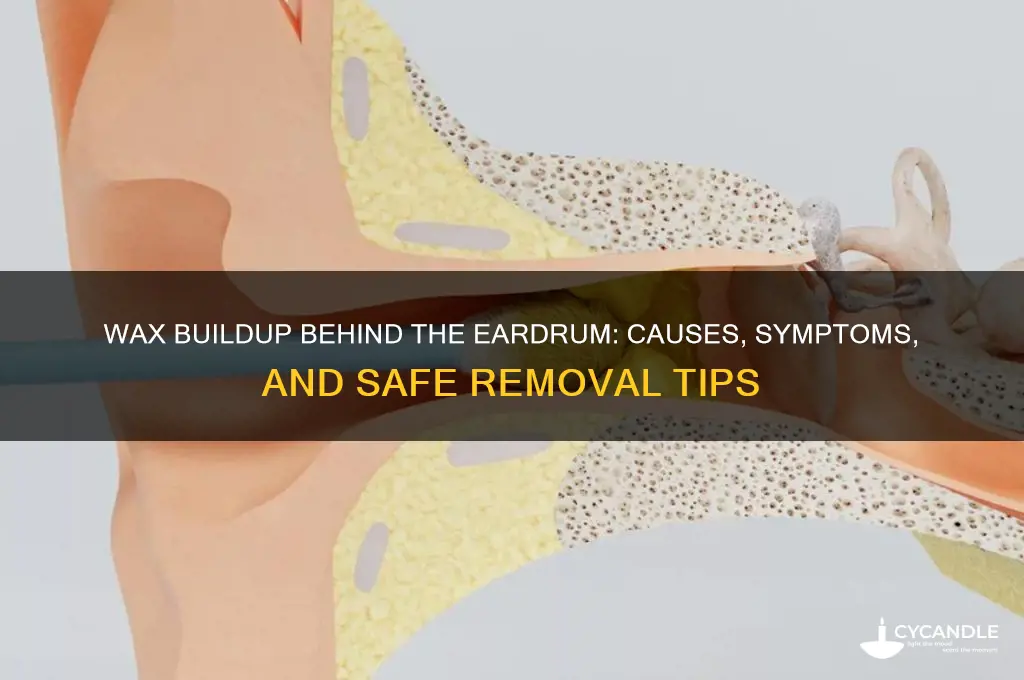 can wax build up behind the eardrum