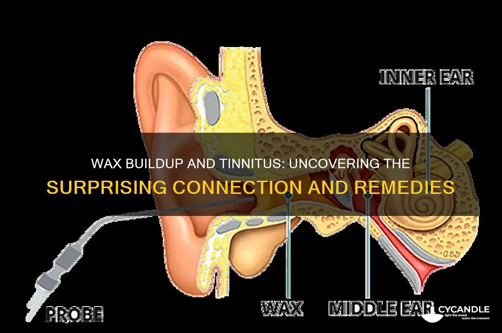 can wax build up cause tinnitus