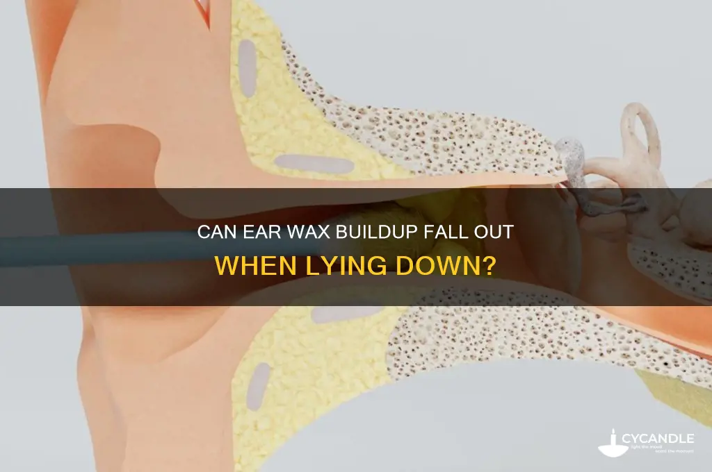 can wax buildup fall if i lay down my ear