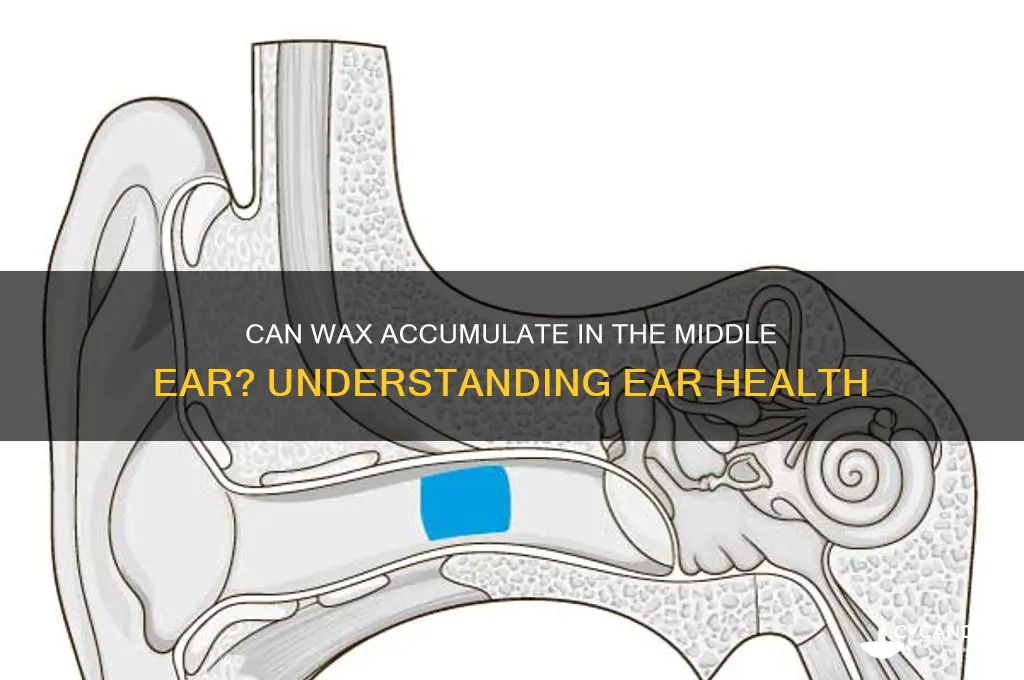 can wax form in middle ear