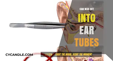 Can Ear Tubes Trap Wax? Understanding Risks and Prevention Tips