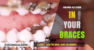 Can Wax Get Stuck in Braces? Tips to Prevent and Remove It