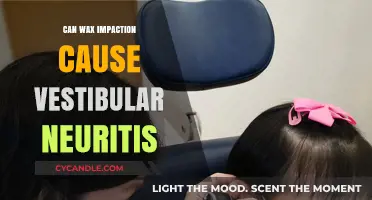 Wax Impaction and Vestibular Neuritis: Unraveling the Potential Connection