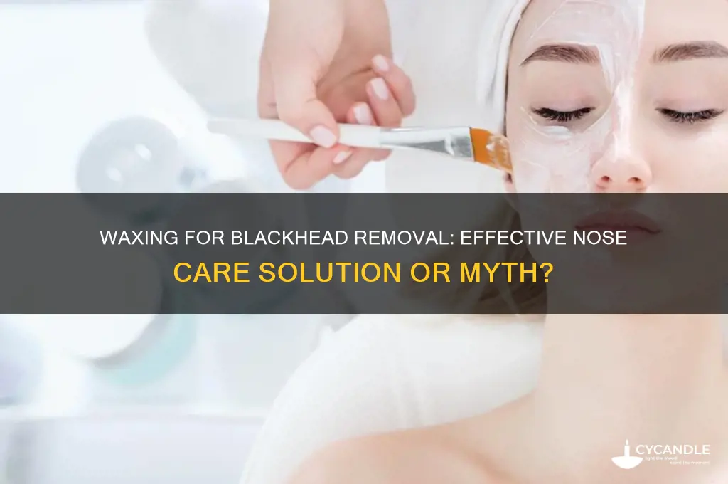 can wax remove blackheads on nose
