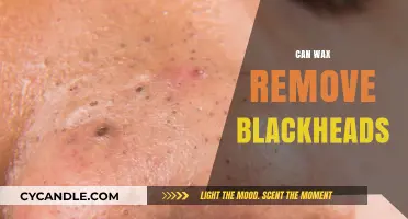 Unclogging Pores: The Truth About Wax and Blackheads Removal