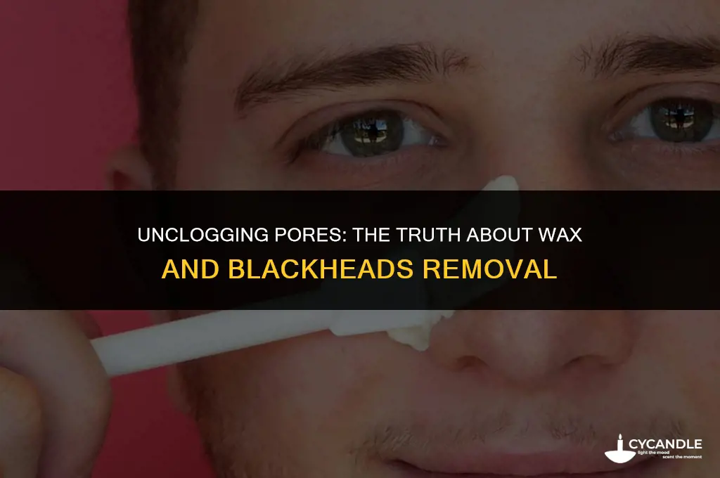 can wax remove blackheads