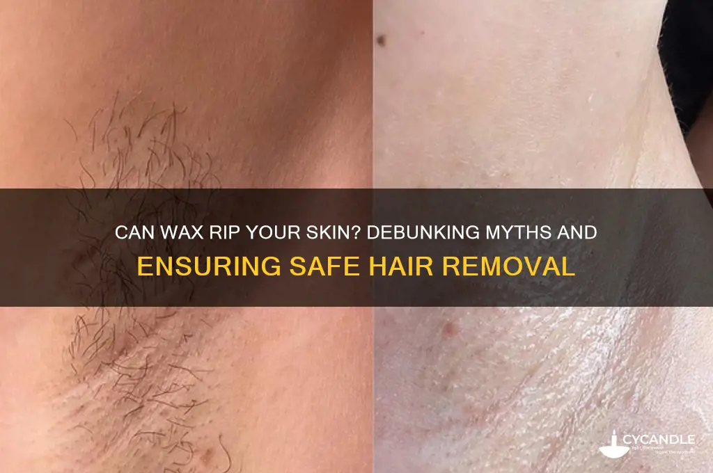 can wax rip your skin