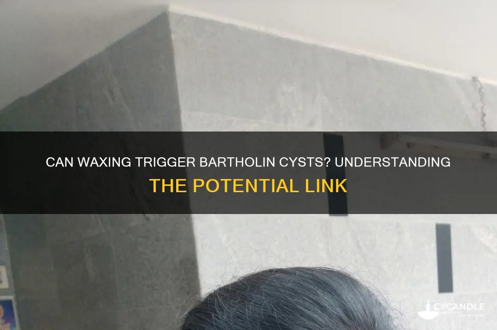can waxing cause a bartholin cyst